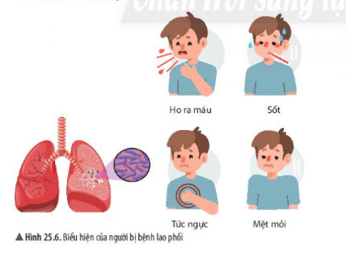 Giai KHTN lớp 6 bài 25 Hình 25.6